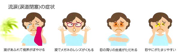 流涙の症状